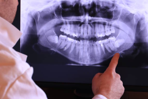 Best Tooth Infection Emergency Dentist  in Keno, OR